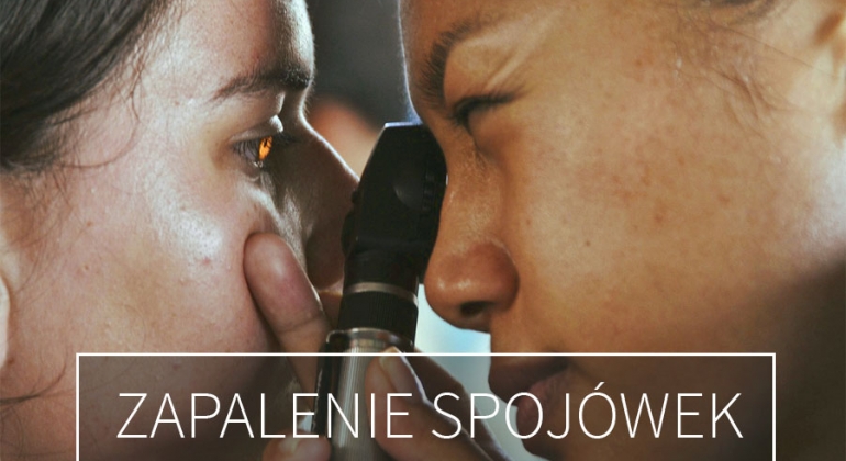 zapalenie spojówek